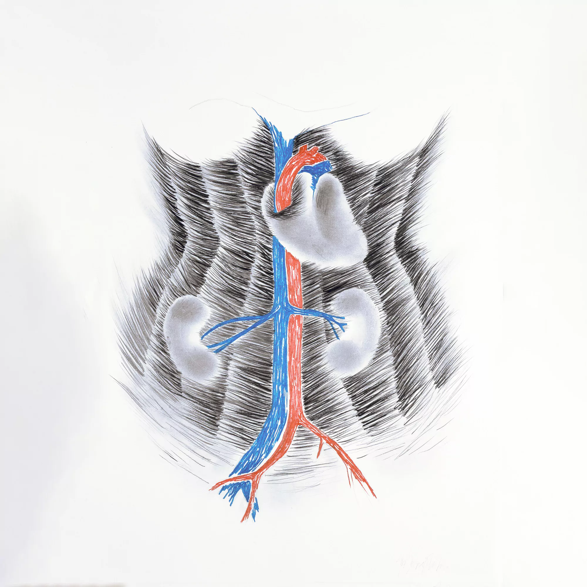 Bomba y filtros de sangre / Bomb and blood filter