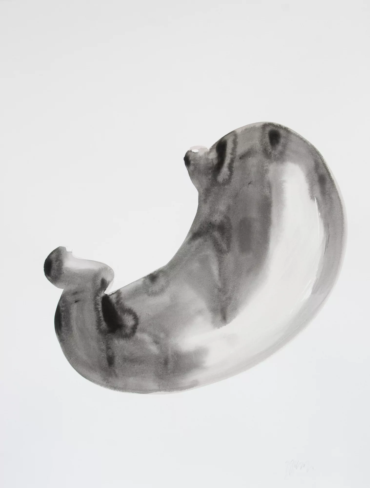 Estómago negro / Black stomach